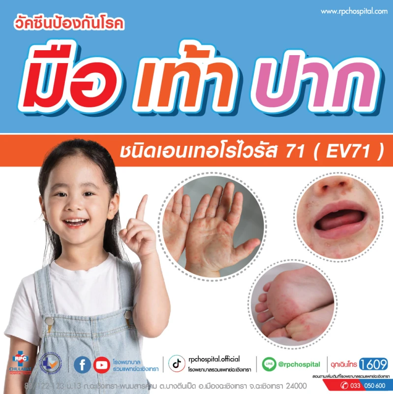 วัคซีนป้องกัน โรค มือ เท้า ปาก ชนิดเอนเทอโรไวรัส 71 (EV71)
