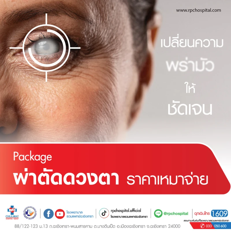 Package ผ่าตัดดวงตา (ราคาเหมาจ่าย)